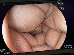 FUJIFILM Video Gastroscope