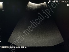 Hitachi Ultrasound Color Doppler