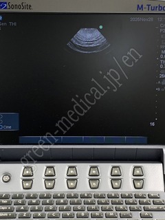 SonoSite Ultrasound Color Doppler