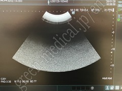 Hitachi Diagnostic Ultrasound System