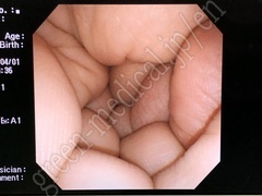 OLYMPUS Video Gastroscope