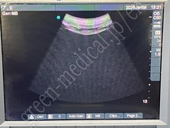 SonoSite Ultrasound Color Doppler