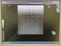 TOSHIBA Ultrasound Color Doppler