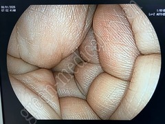 FUJIFILM Processor & Laser Lightsource