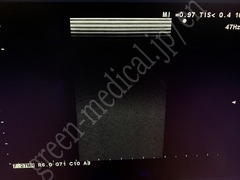 Hitachi Ultrasound Color Doppler