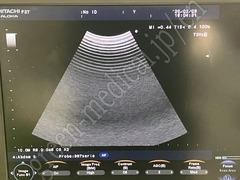 Hitachi Color Doppler Ultrasound System