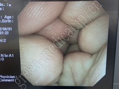 OLYMPUS Video Bronchoscope