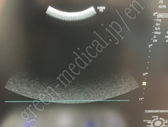 GE Healthcare Diagnostic Ultrasound System