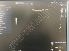 GE Healthcare Ultrasound Color Doppler