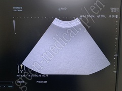 Hitachi Ultrasound Diagnostic System