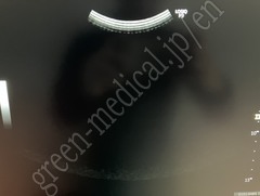 GE Healthcare Diagnostic Ultrasound System