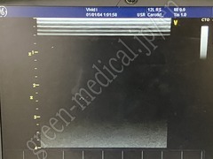 GE Healthcare Portable Ultrasound Color Doppler