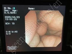 OLYMPUS Video Colonoscope