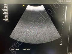 SIEMENS Diagnostic Ultrasound System