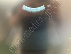 GE Healthcare Ultrasound Color Doppler