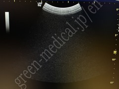 GE Healthcare Ultrasound Color Doppler