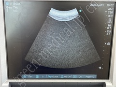 SonoSite Ultrasound Color Doppler