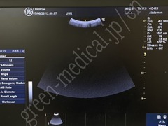 GE Healthcare Ultrasound Color Doppler