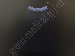 GE Healthcare 4D Ultrasound Color Doppler