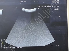 Hitachi Ultrasound Color Doppler