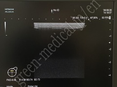 Hitachi Ultrasound Diagnostic System
