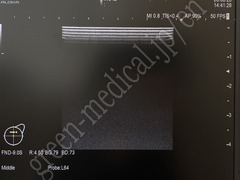 Hitachi Ultrasound Diagnostic System