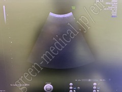 GE Healthcare Diagnostic Ultrasound System