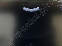 GE Healthcare Diagnostic Ultrasound System
