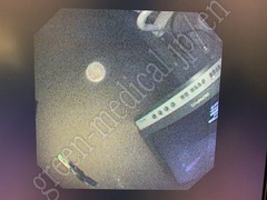 OLYMPUS Video Gastroscope