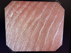 OLYMPUS Video Gastroscope