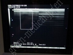 HONDA ELECTRONICS Diagnostic Ultrasound Scanner (BW system)