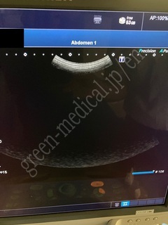 TOSHIBA Ultrasound Color Doppler