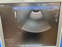 TOSHIBA Ultrasound Color Doppler