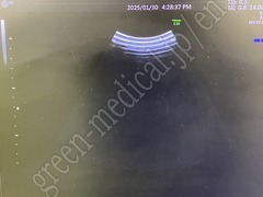 GE Healthcare Diagnostic Ultrasound System