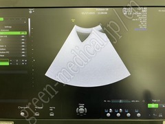 GE Healthcare Diagnostic Ultrasound System