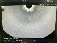 Hitachi Color Doppler Ultrasound System