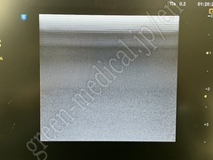 SAMSUNG Ultrasound Color Doppler