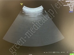 GE Healthcare Diagnostic Ultrasound System
