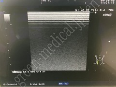Hitachi Ultrasound Color Doppler