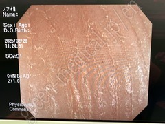 OLYMPUS Video Colonosope