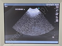 SonoSite Portable Ultrasound Color Doppler