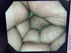 OLYMPUS Processor & Xenon Lightsource