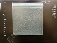 TOSHIBA Ultrasound Color Doppler