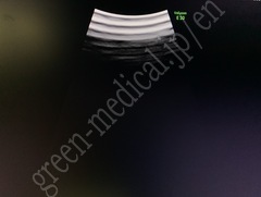 GE Healthcare Diagnostic Ultrasound System