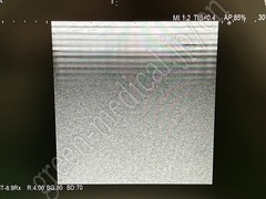 Hitachi Ultrasound Diagnostic System