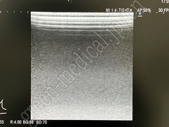 Hitachi Diagnostic  Ultrasound System