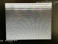 Hitachi Ultrasound Diagnostic System