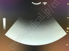 GE Healthcare Ultrasound Color Doppler