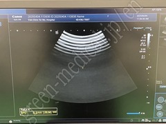 TOSHIBA Diagnostic Ultrasound System