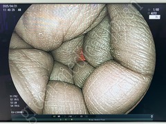 FUJIFILM Video Processor & Laser Lightsource